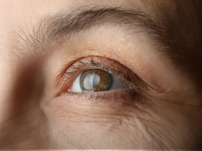 Cirurgia de Catarata em Curitiba