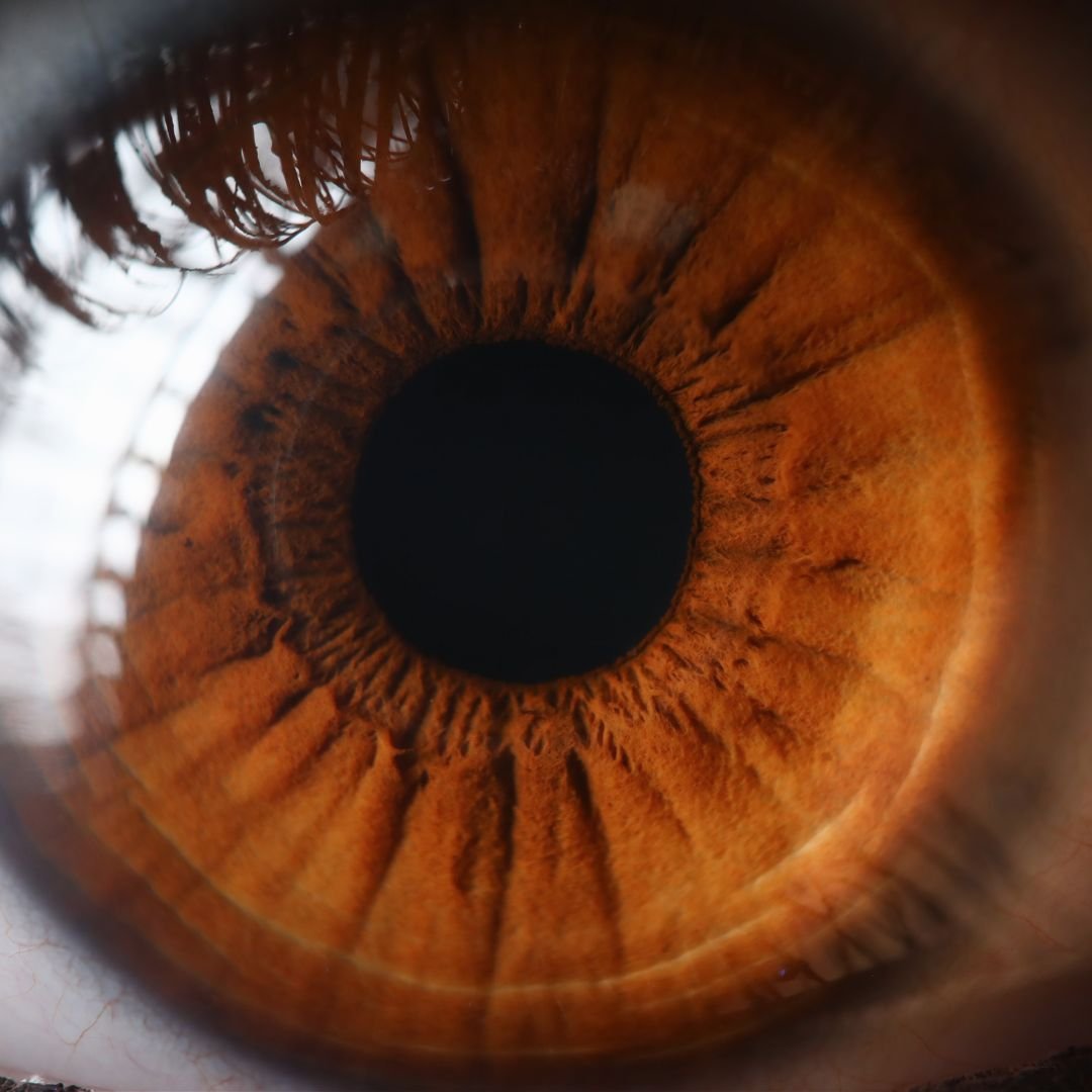 Transplante de Cornea em Curitiba