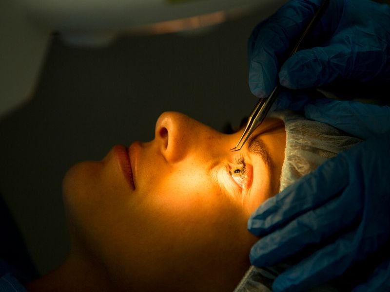 Cirurgia LASIK em Curitiba