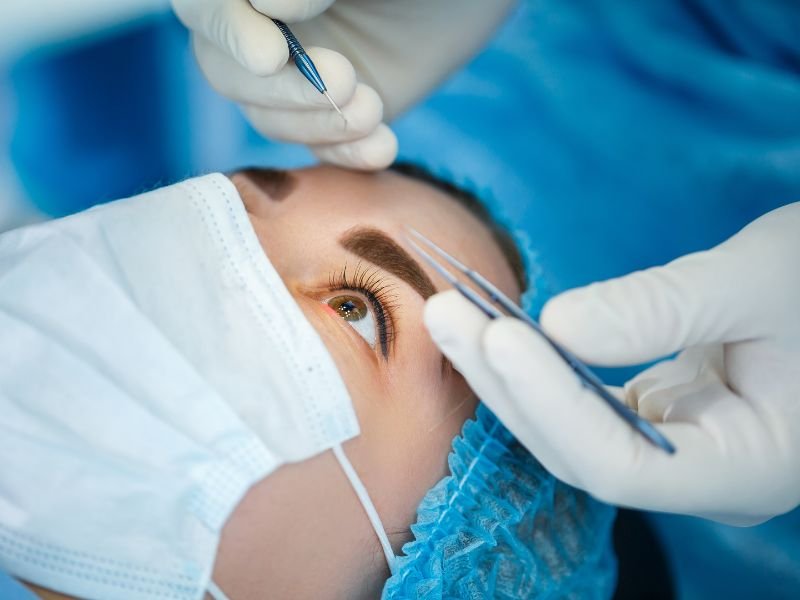 Cirurgia Refrativa a Laser em Curitiba