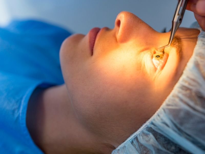 Cirurgia Refrativa em Curitiba