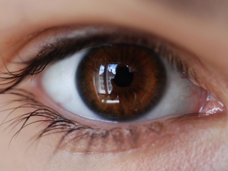 Implante de Lente Facica em Curitiba