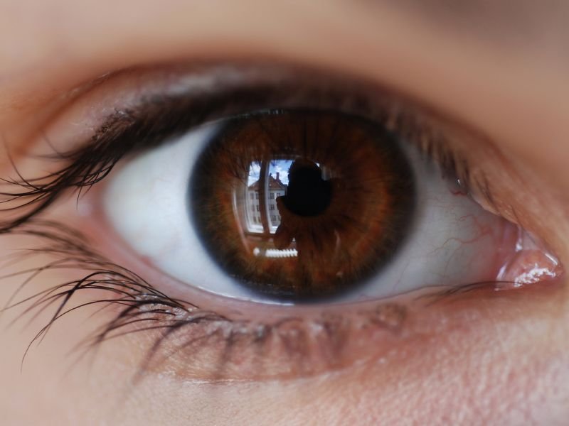 Implante de Lente Facica em Curitiba