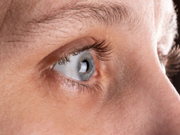 Oftalmologista Especialista em Ceratocone em Curitiba