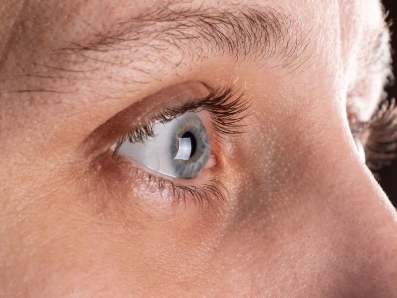 Oftalmologista Especialista em Ceratocone em Curitiba