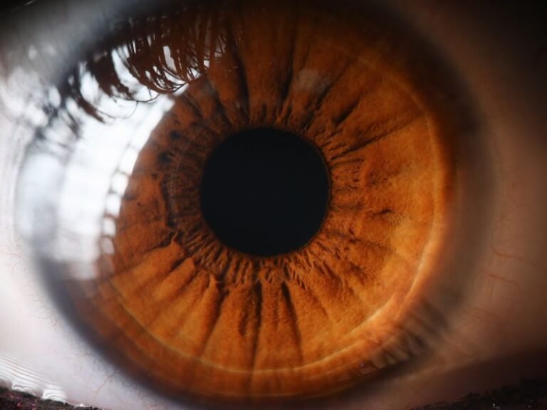 Transplante de Cornea em Curitiba