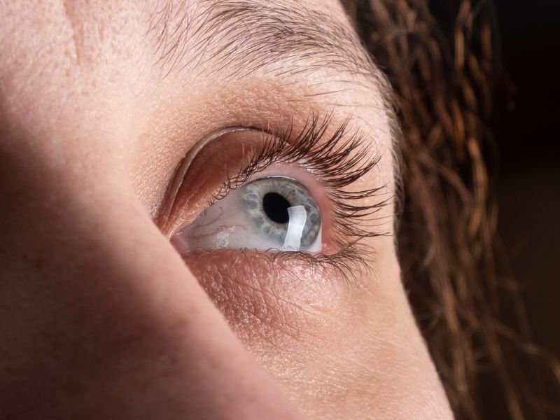 Tratamento para Ceratocone em Curitiba